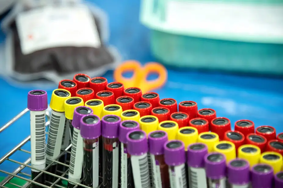 A collection of blood samples in tubes