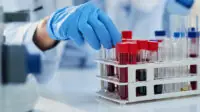 A scientist examines a patient's blood during a clinical trial