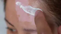 A woman with vitiligo applies cream to her forehead