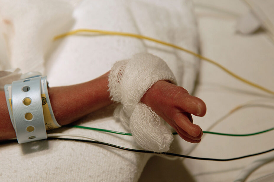 A photo of a premature infant's foot in a neonatal intensive care unit