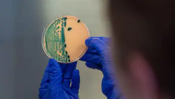 A scientist examines a Petri dish with a bacteria sample