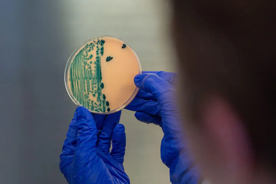 A scientist examines a Petri dish with a bacteria sample