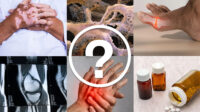 Collage of images with white question mark in a white circle in the middle. Images include virtiligo, joint pain, knee x-ray, pain in hands, pills and pill bottles