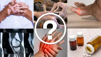 Collage of images with white question mark in a white circle in the middle. Images include virtiligo, joint pain, knee x-ray, pain in hands, pills and pill bottles