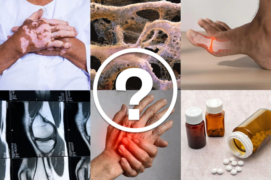 Collage of images with white question mark in a white circle in the middle. Images include virtiligo, joint pain, knee x-ray, pain in hands, pills and pill bottles