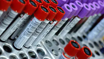 A collection of blood samples in test tubes