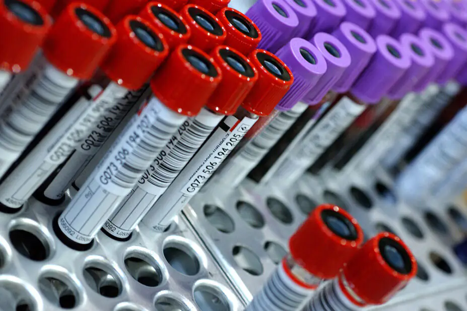 A collection of blood samples in test tubes