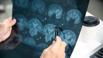 Physician looking at x-ray films of a brain
