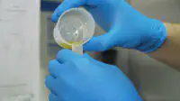A scientist holds a urine sample for analysis