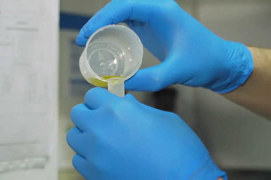 A scientist holds a urine sample for analysis