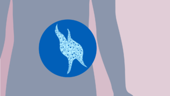Pink background, grey body and blue cancer cells visible