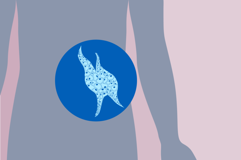 Pink background, grey body and blue cancer cells visible