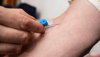 A person receives a treatment through an iv drip