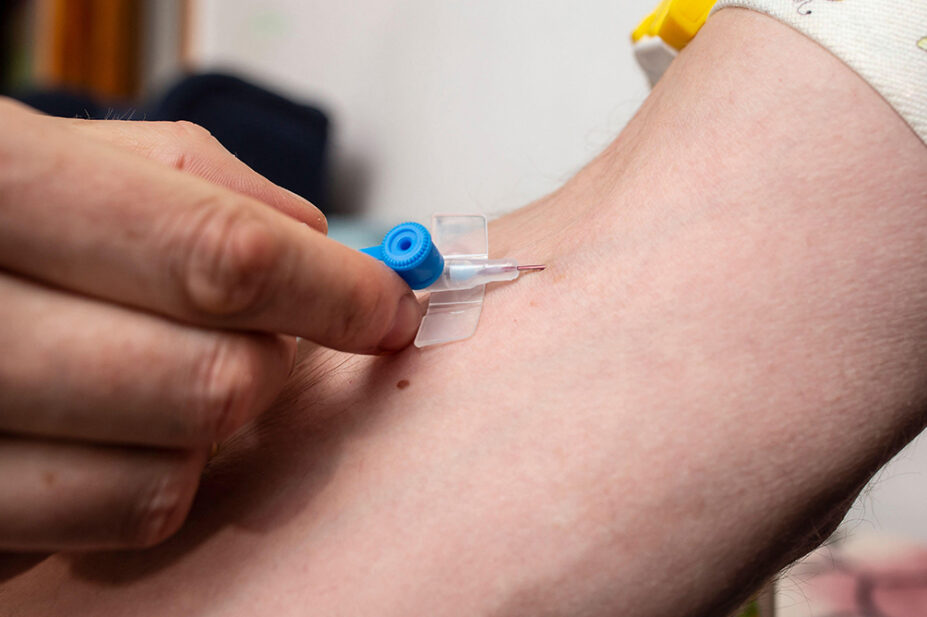 A person receives a treatment through an iv drip