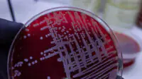 A close-up image of a sample of bacteria in a Petri dish