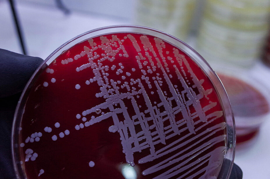 A close-up image of a sample of bacteria in a Petri dish