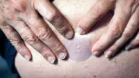 A woman places a menopausal hormone therapy patch on her stomach