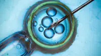 Blue background, IVF injection into egg concept. Text reading 