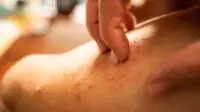 Scratching on rash on leg skin