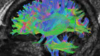Cross section of the brain in black and white, brain is illuminated in many colours: pinks, blues, yellows and greens