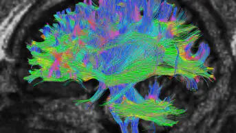 Cross section of the brain in black and white, brain is illuminated in many colours: pinks, blues, yellows and greens