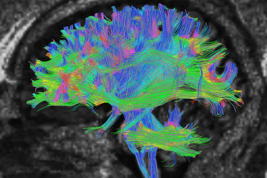Cross section of the brain in black and white, brain is illuminated in many colours: pinks, blues, yellows and greens