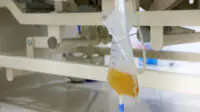 Urine catheter bag hang under patient bed in hospital