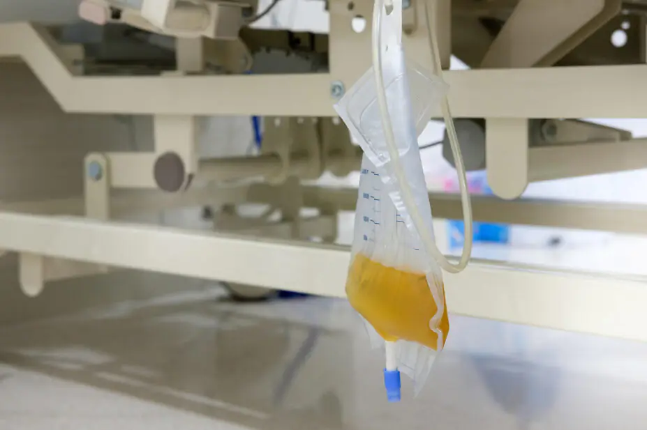Urine catheter bag hang under patient bed in hospital
