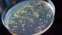 A bacteria sample in a petri dish
