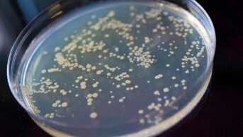 A bacteria sample in a petri dish