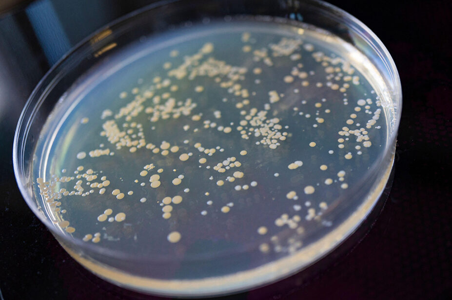 A bacteria sample in a petri dish