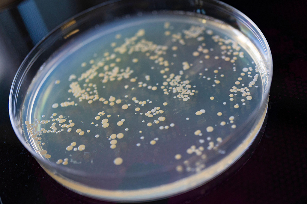 Global Study Reveals Widespread Overuse of Powerful Antibiotics