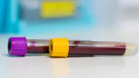 A close-up of two vials of blood