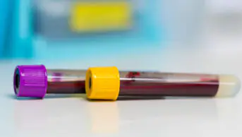 A close-up of two vials of blood