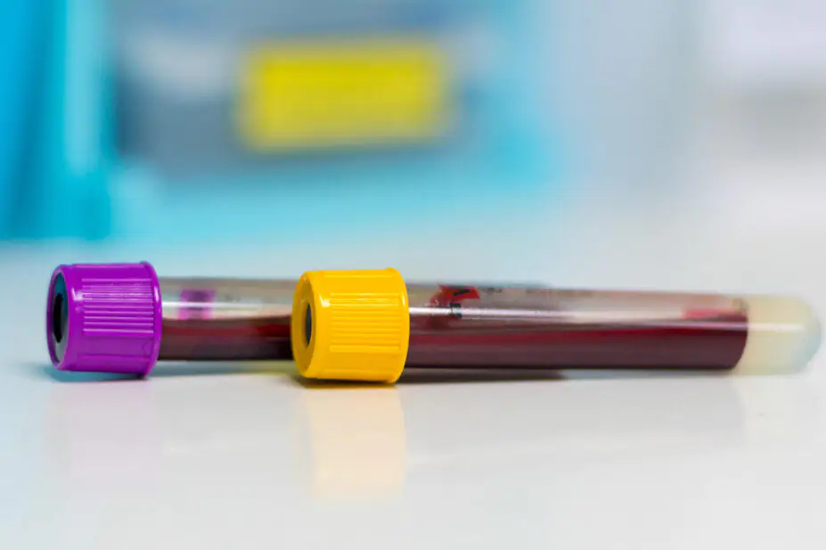 A close-up of two vials of blood