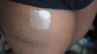 An image of a hormone replacement therapy patch on a woman's thigh