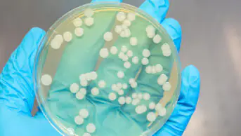 A bacteria sample in a petri dish