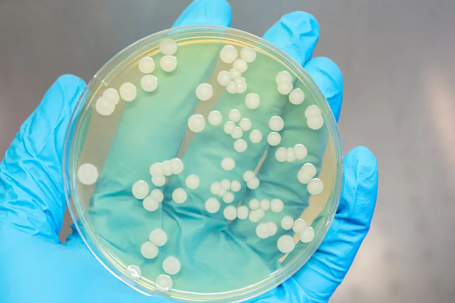 A bacteria sample in a petri dish