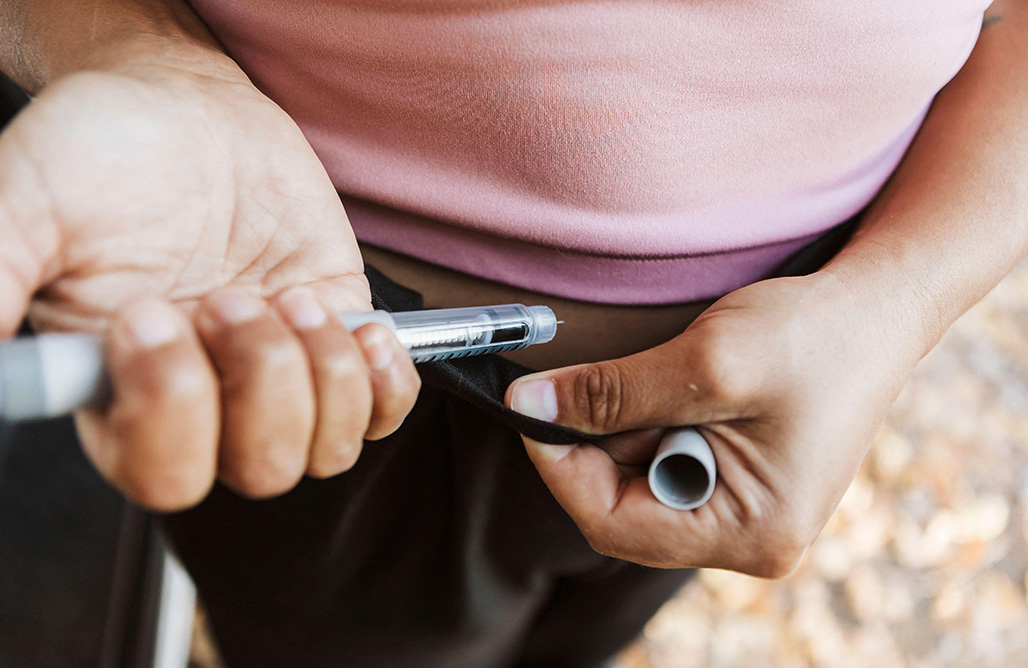 Survey warns of ‘lifestyle drive’ for weight-loss medication