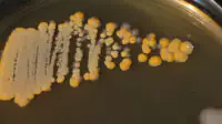 A close-up of bacteria sample in a petri dish