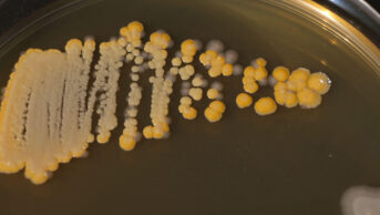 A close-up of bacteria sample in a petri dish