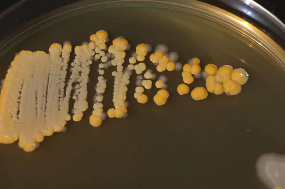 A close-up of bacteria sample in a petri dish
