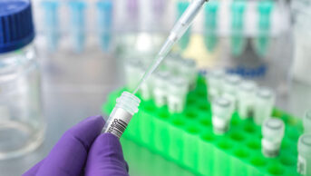 A scientist prepares a DNA sample for analysis