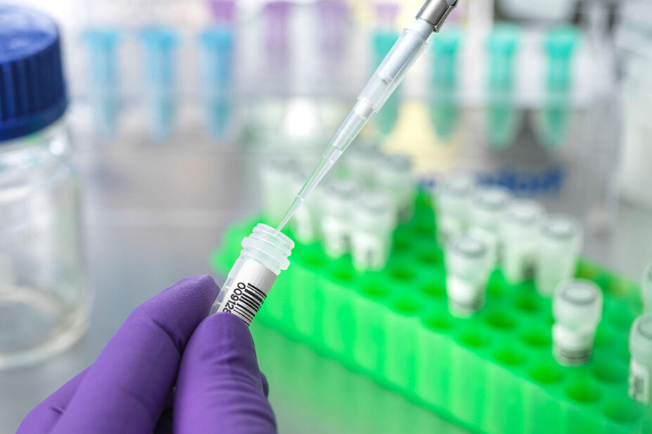 A scientist prepares a DNA sample for analysis
