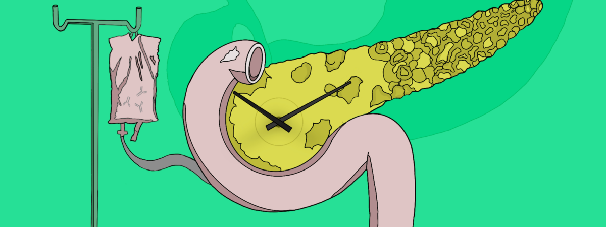 Green background with IV leading into a pancreas. Clock hands visible too