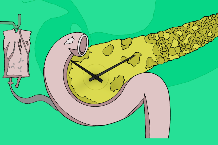 Green background with IV leading into a pancreas. Clock hands visible too