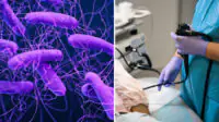 Left image, purple background with bacteria with long flagella visible, right image shows a doctor performing an endoscopy