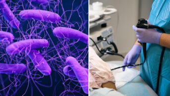 Left image, purple background with bacteria with long flagella visible, right image shows a doctor performing an endoscopy