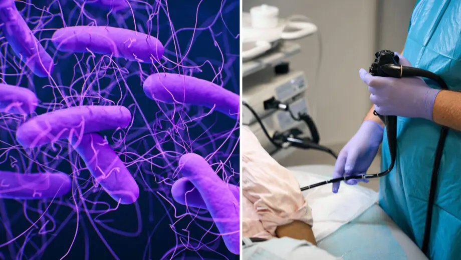 Left image, purple background with bacteria with long flagella visible, right image shows a doctor performing an endoscopy