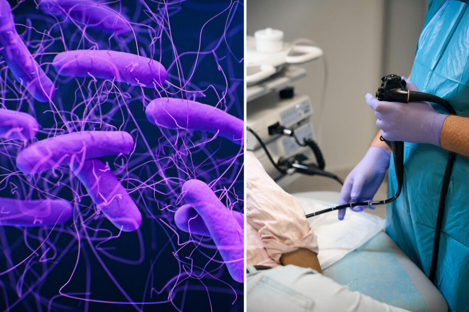 Left image, purple background with bacteria with long flagella visible, right image shows a doctor performing an endoscopy